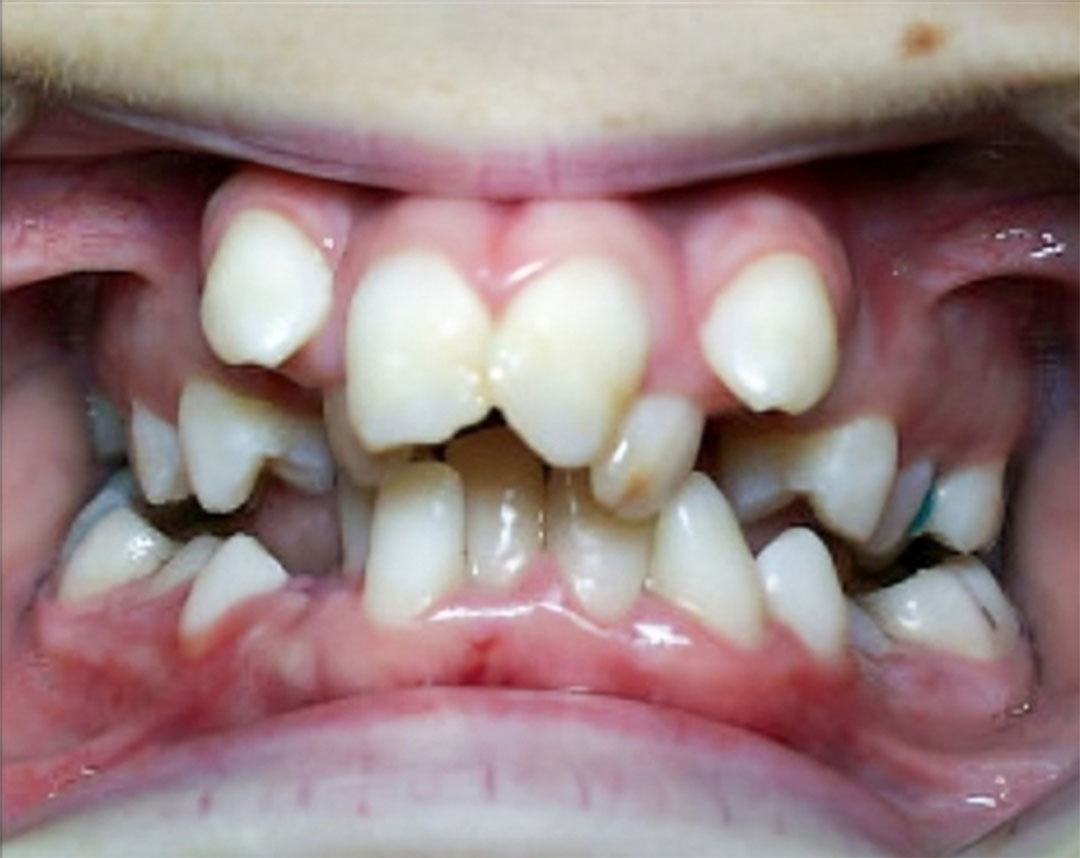 Redding CA Orthodontic Treatment