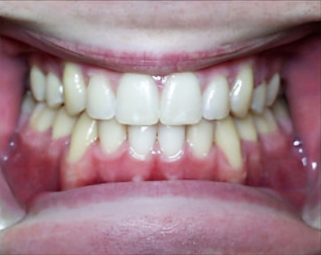 Orthodontics in Redding CA