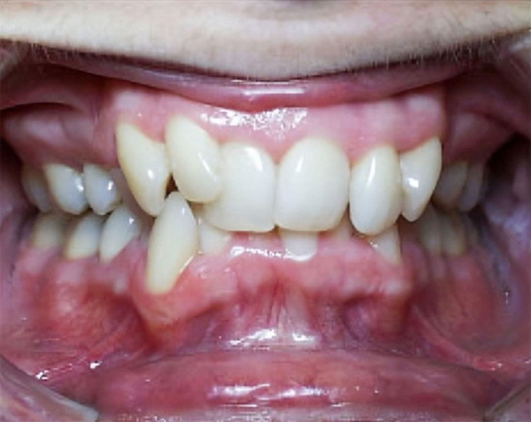 Redding CA Orthodontic Services