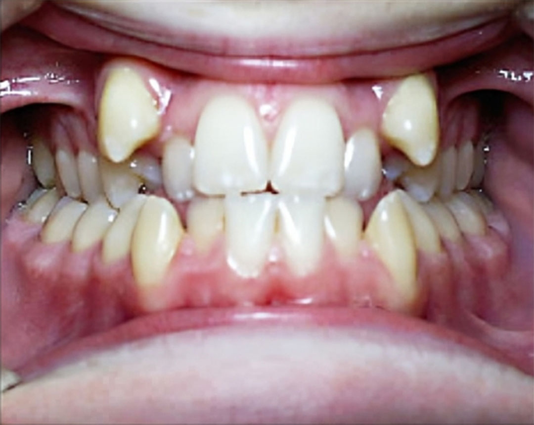 Redding CA Orthodontics
