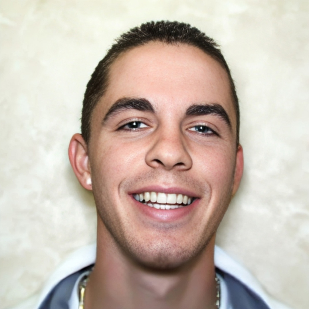 Redding CA Orthodontist Patient