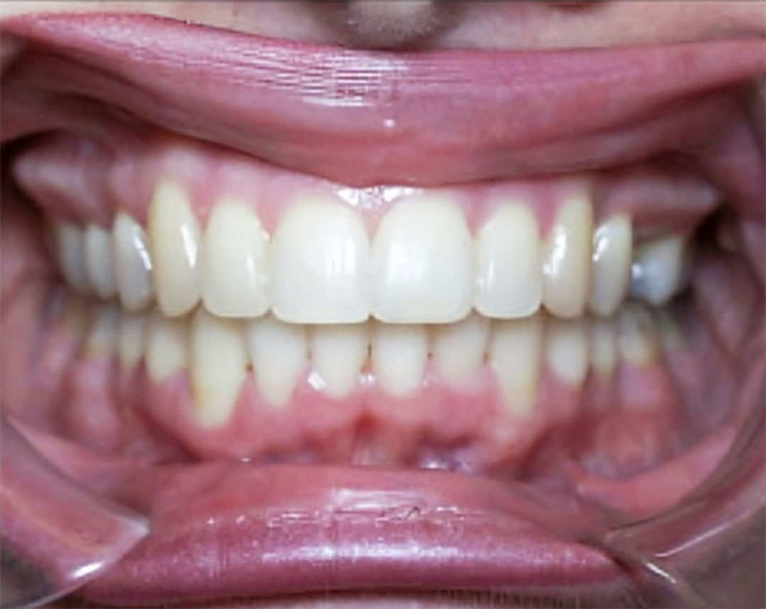 Orthodontic Services in Redding CA