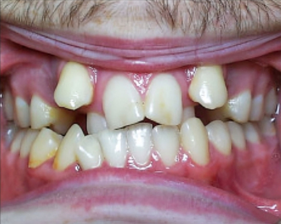 Redding CA Orthodontic Care