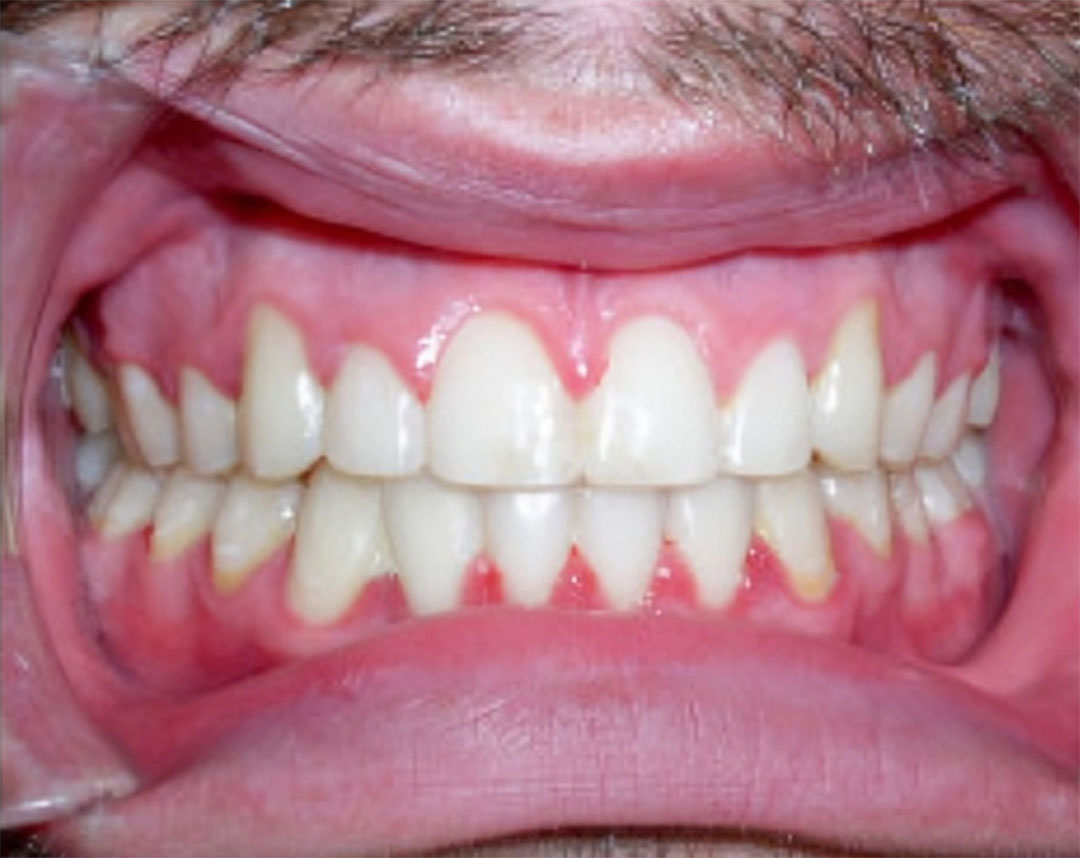 Orthodontic Care in Redding CA