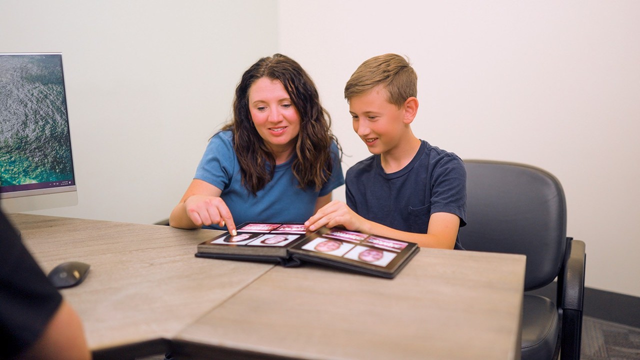 Palatal expander at Shasta Orthodontics, Redding CA